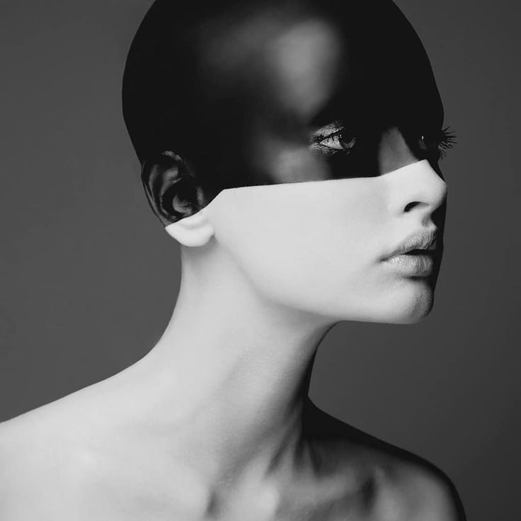 Acne Vulgaris